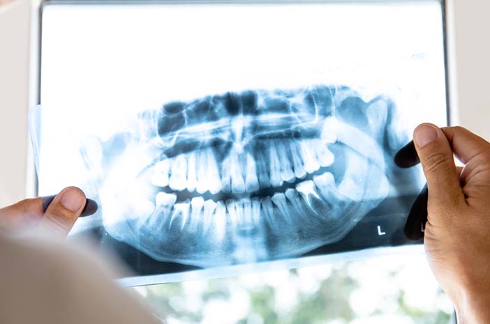 Rontgen Gigi Panoramic
