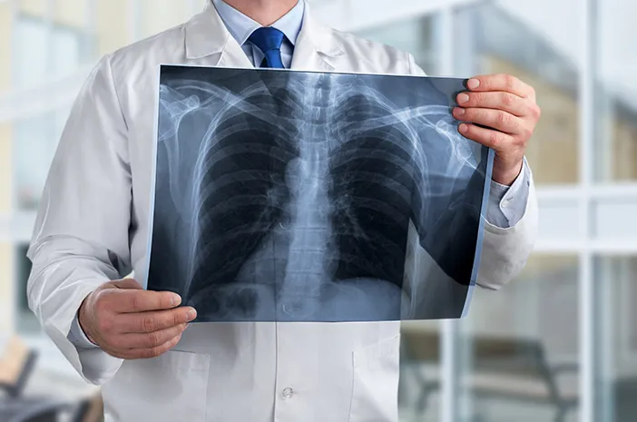 💡 Kapan Kita Harus Melakukan Pemeriksaan Radiologi?